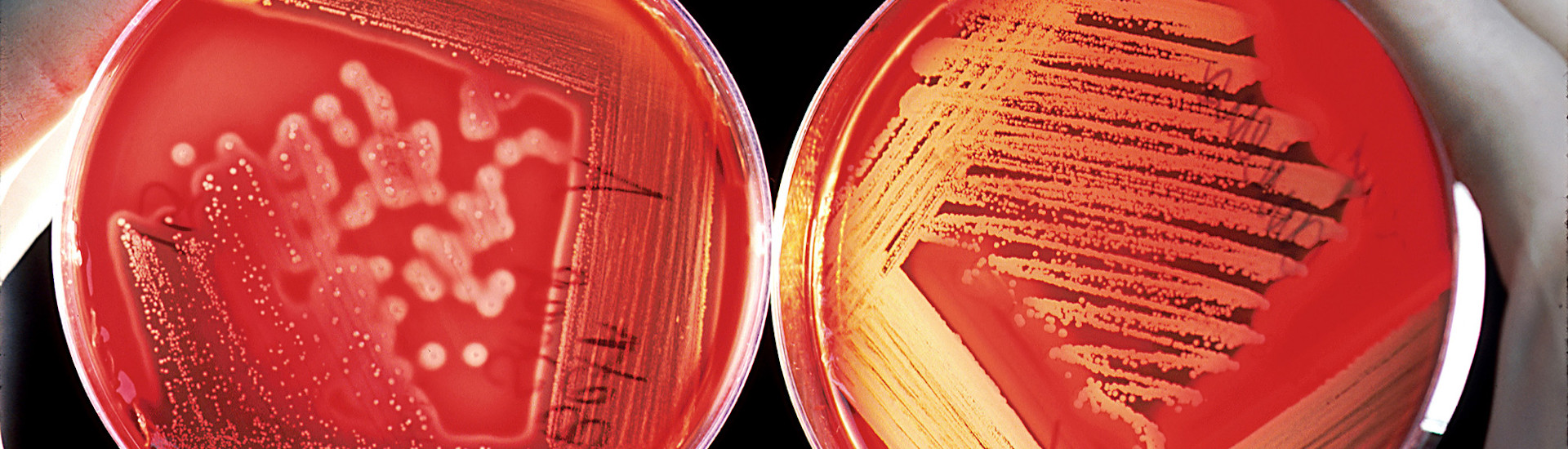 Salmonella e Campylobacter, stabile il numero dei casi in Europa. Il rapporto Efsa-Ecdc