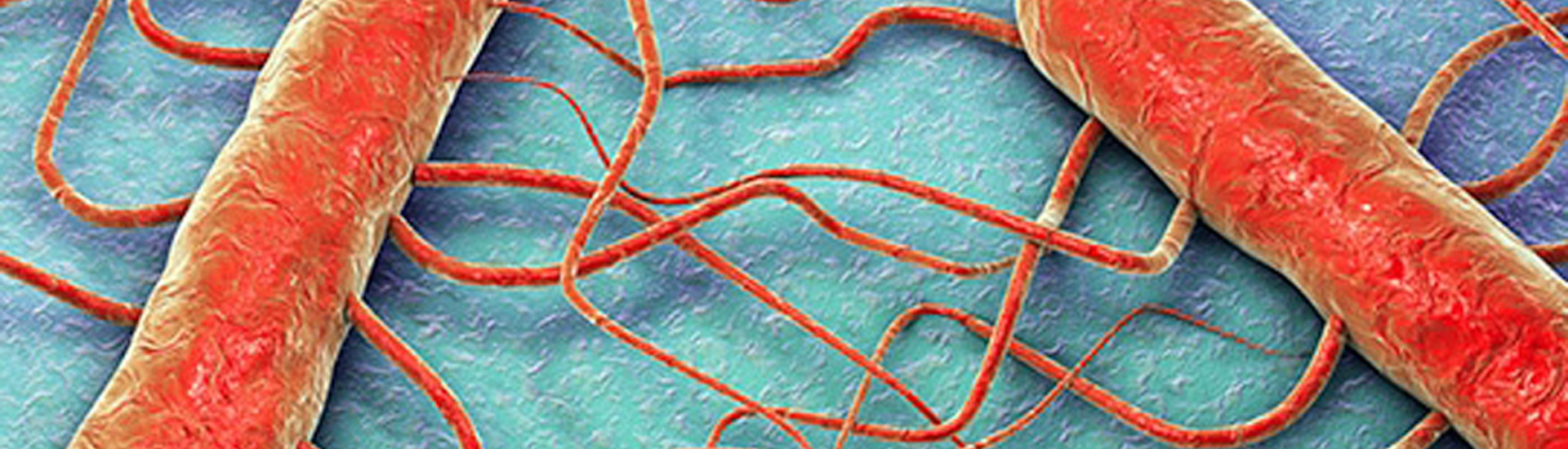 Listeria: tutti i segreti di un batterio insidioso che resiste anche alle temperature del frigorifero