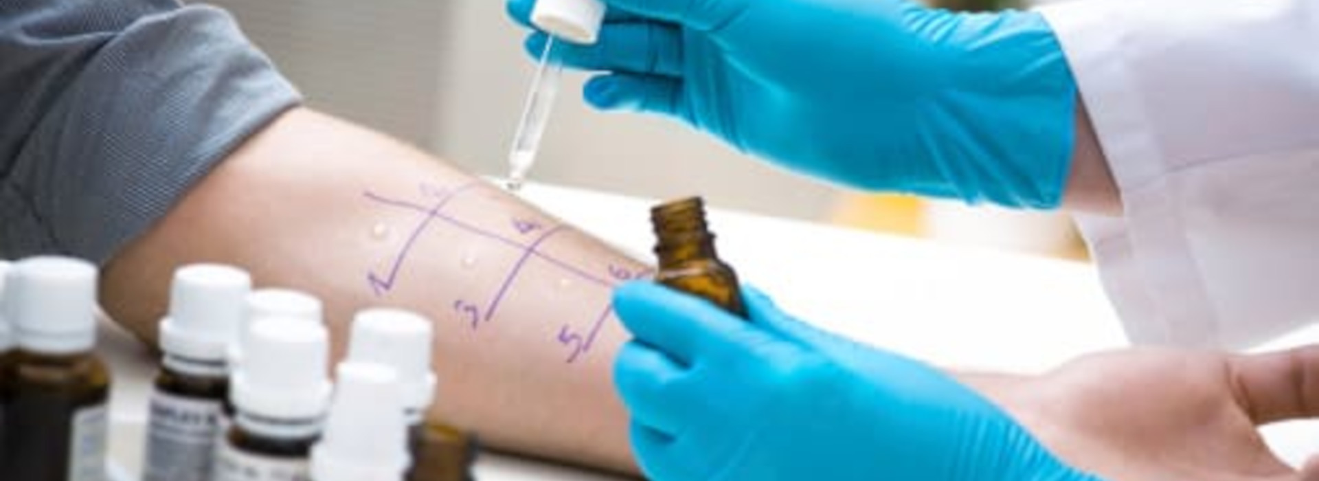 Shock anafilattico da alimenti: accesso ai farmaci salvavita frammentario e scarsa formazione nei ristoranti