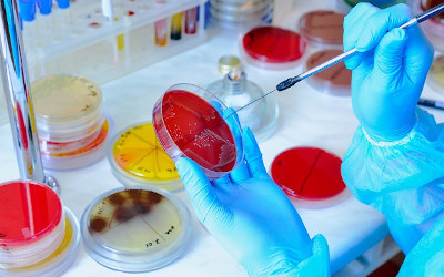 Antimicrobico-resistenza: Rapporto congiunto Efsa-Ecdc