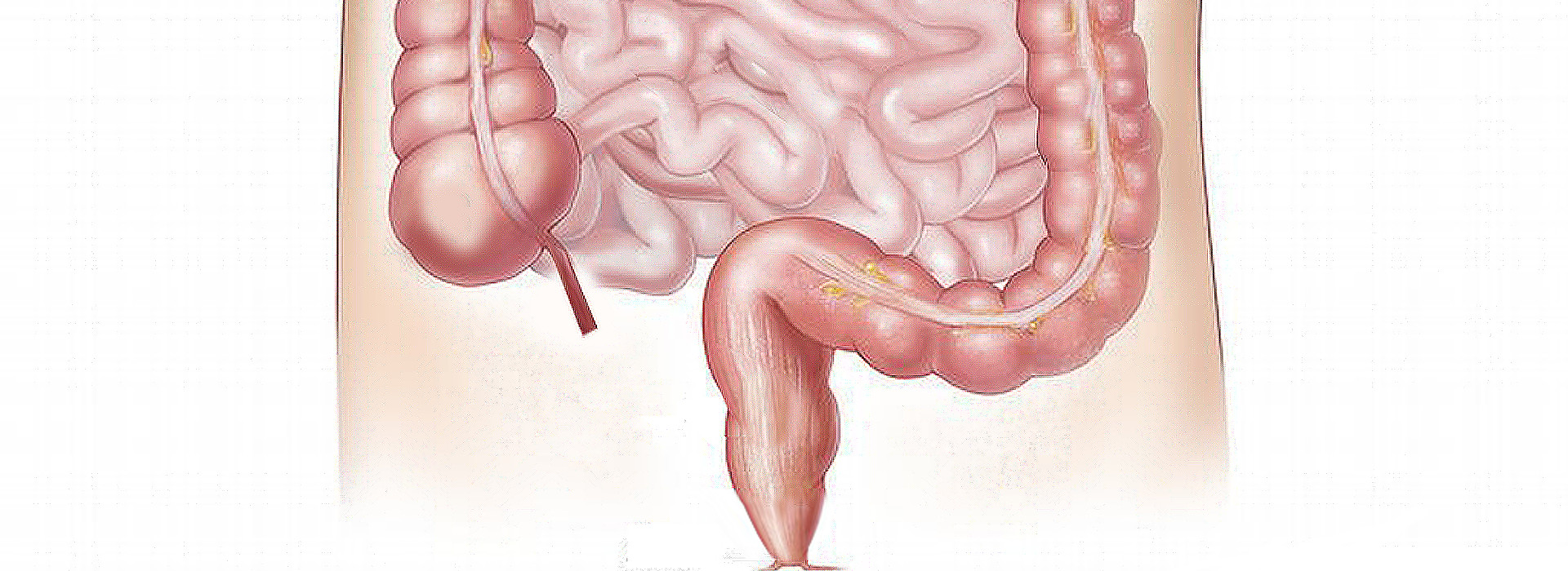 Sindrome del colon irritabile: l’importanza di un’alimentazione corretta