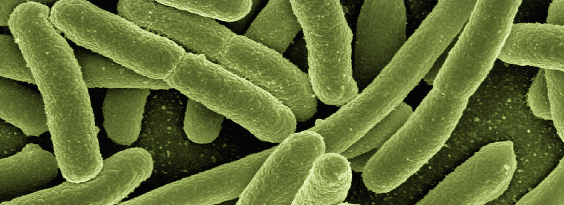 Legionella in Italia: cosa c’è da sapere, come prevenire e quando rivolgersi a un laboratorio analisi