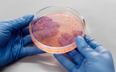Listeria negli alimenti pronti: cosa cambia con le nuove regole europee dal 2026