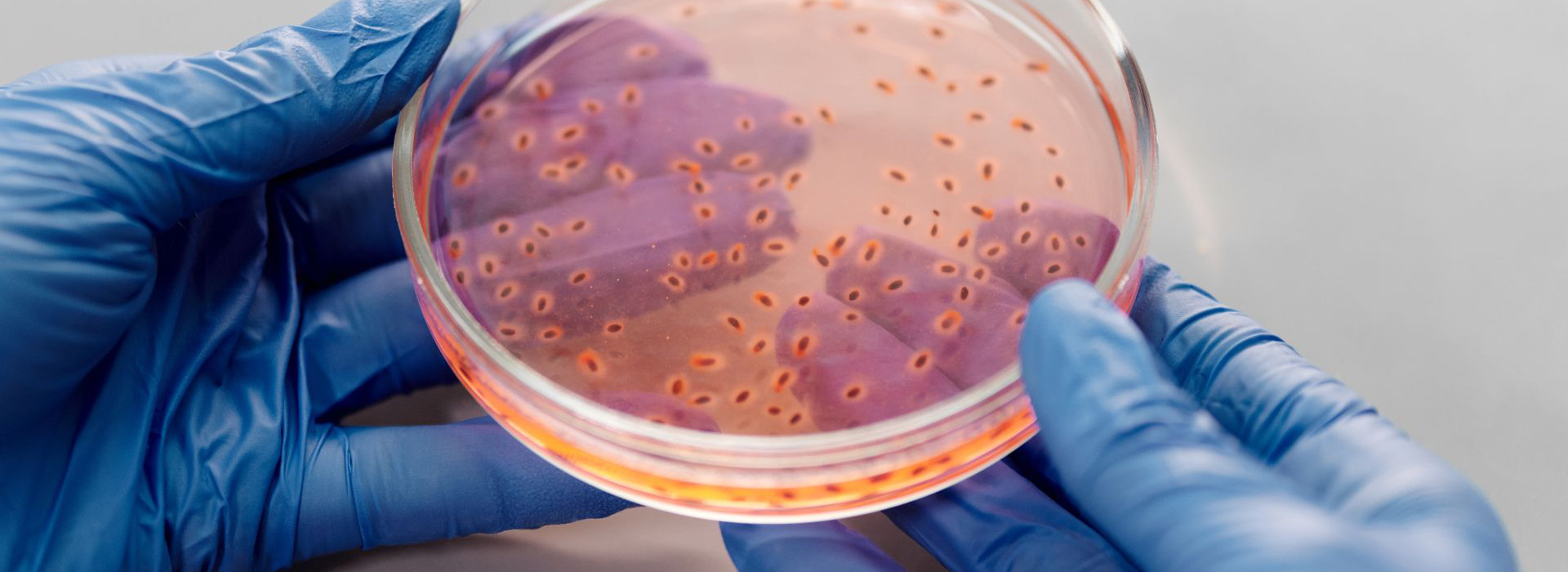 Listeria negli alimenti pronti: cosa cambia con le nuove regole europee dal 2026