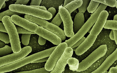 Listeria negli alimenti: come ridurre i rischi a tavola