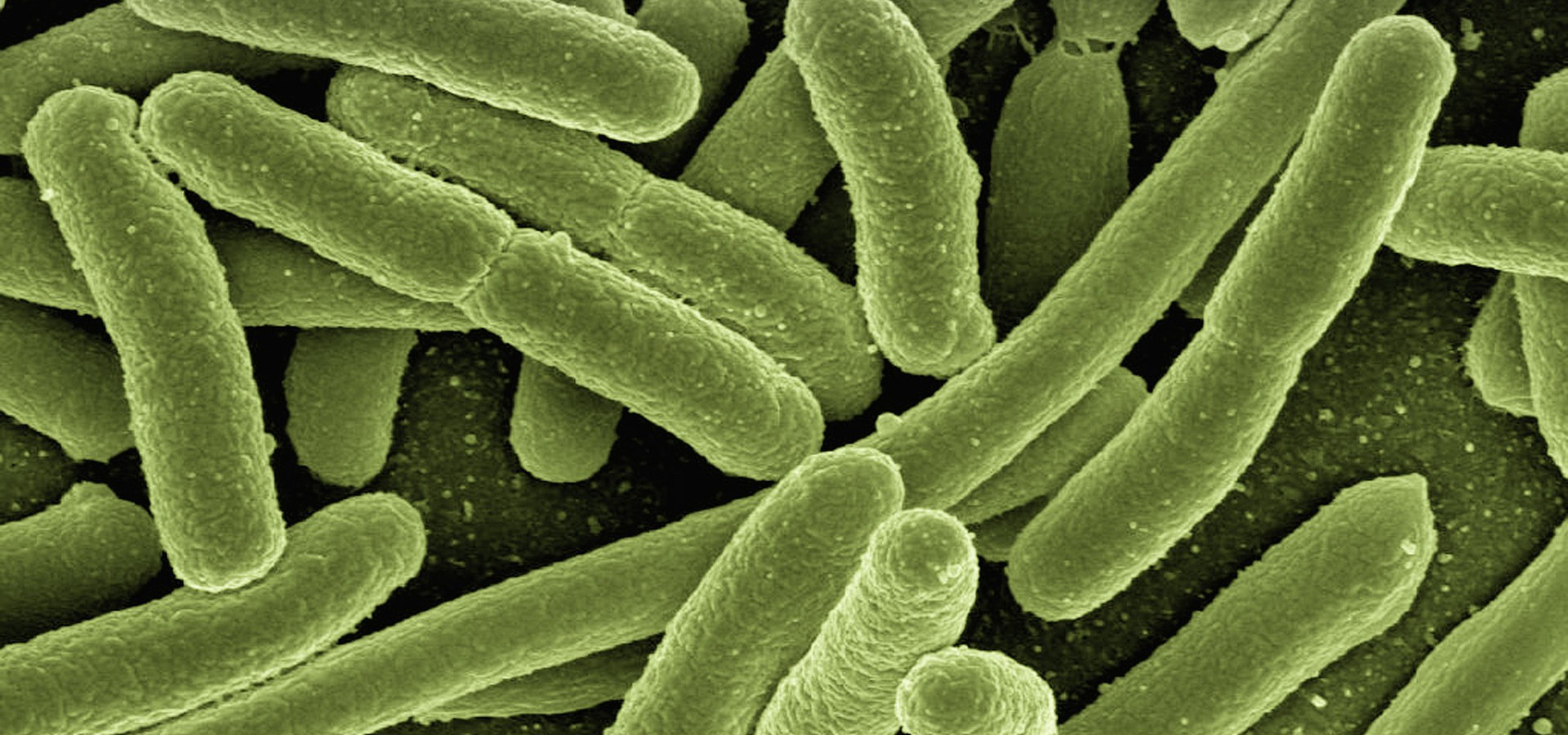 Listeria negli alimenti: come ridurre i rischi a tavola