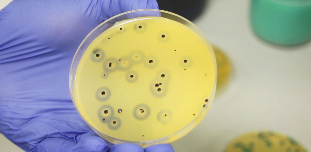 Analisi microbiologiche